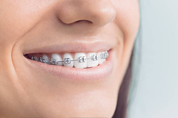 Best Traditional Braces  in Rolesville, NC
